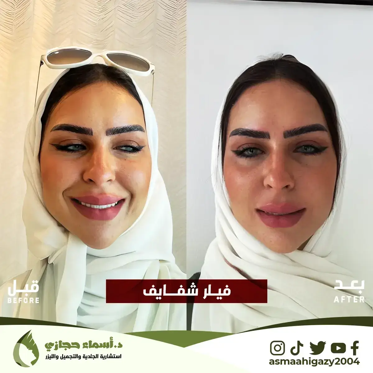 Jo-25-Apr-23-B&Amp;A-Filler-3 Copy