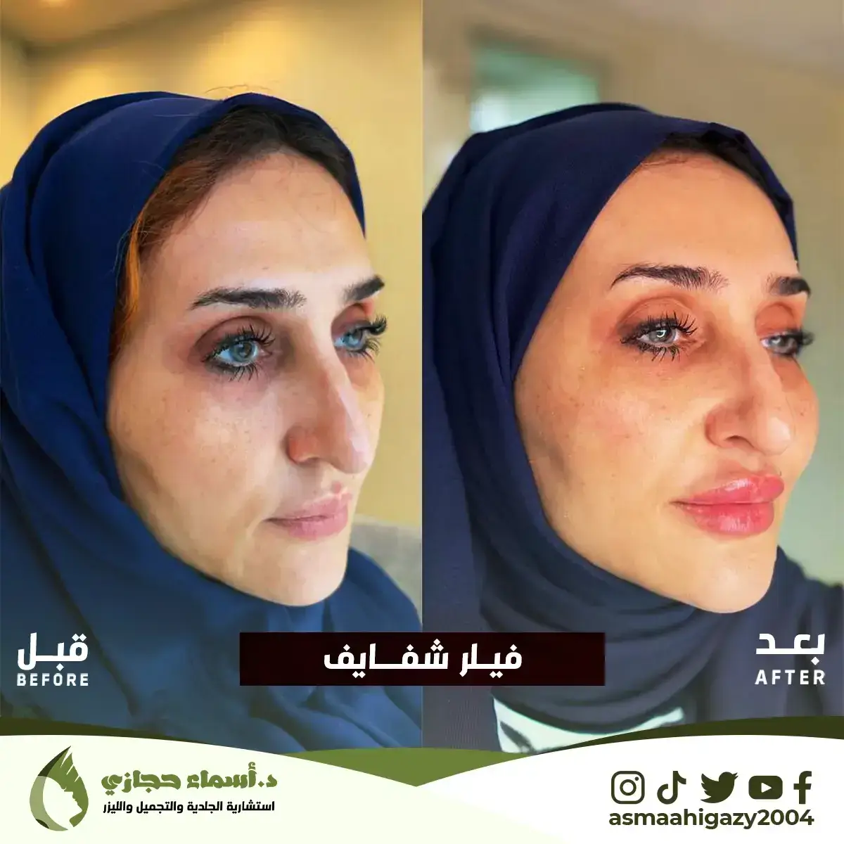 Jo-25-Apr-23-B&Amp;A-Filler-4 Copy