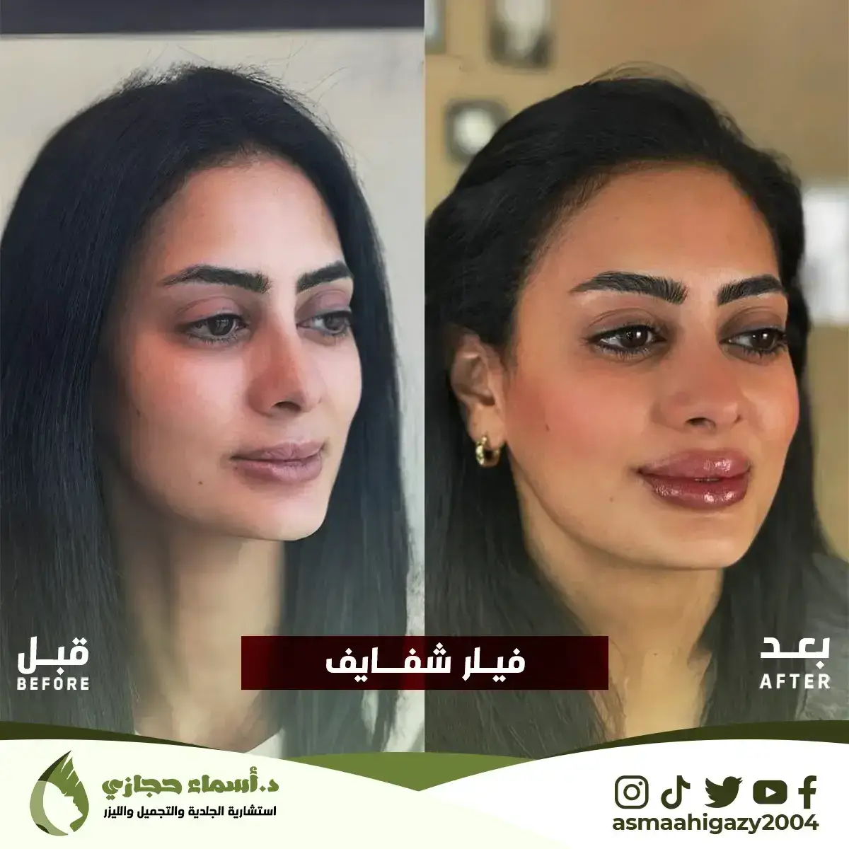 Jo-25-Apr-23-B&Amp;A-Filler-5 Copy