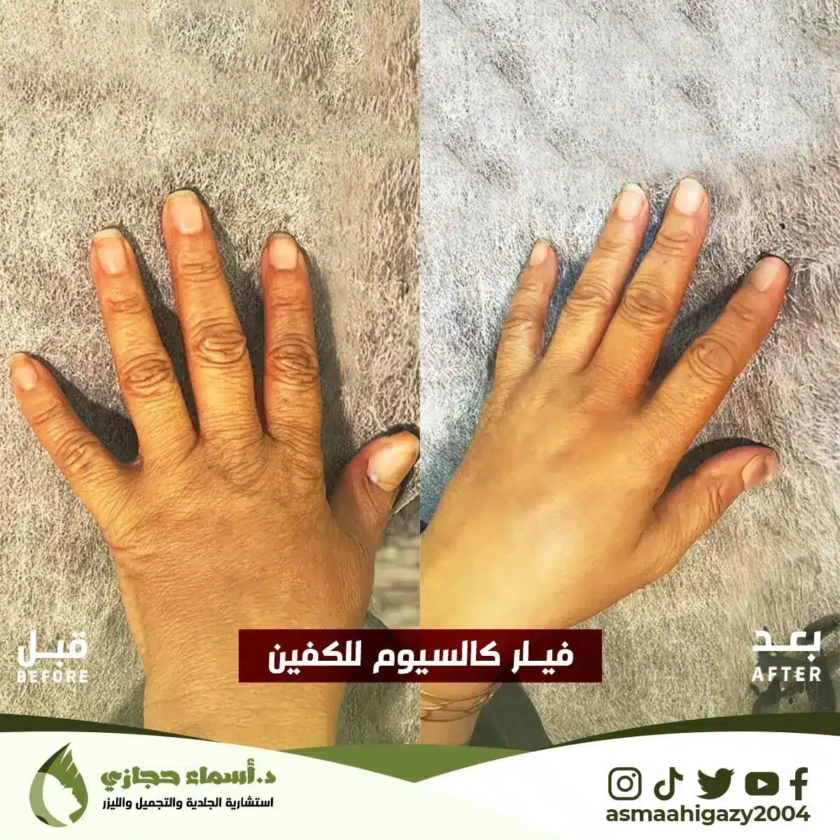 Jo-25-Apr-23-B&Amp;A-Filler-6 Copy