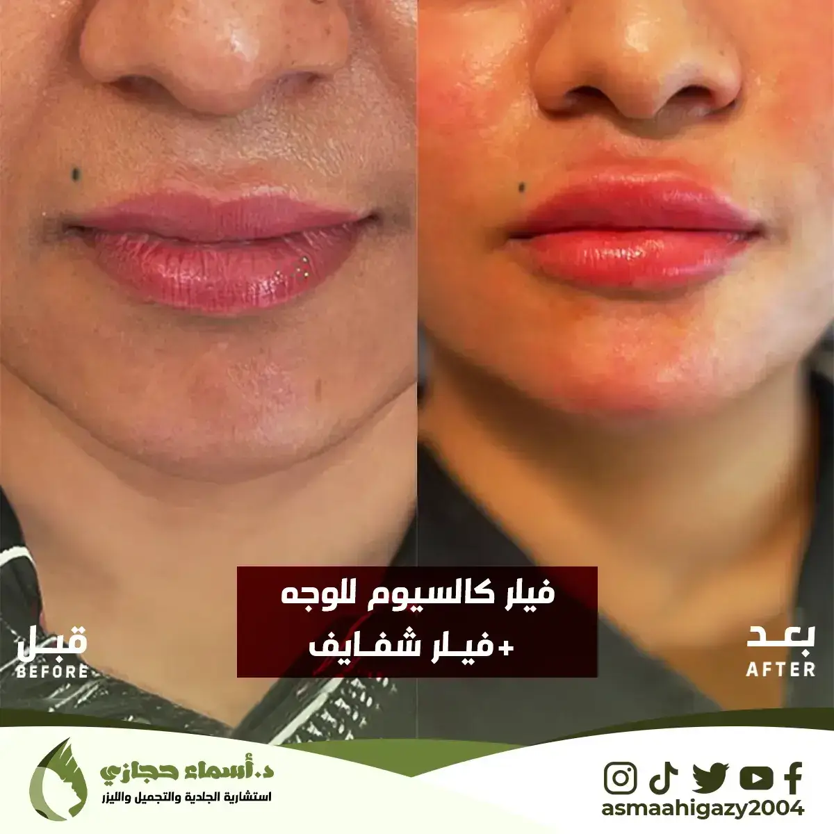 Jo-25-Apr-23-B&Amp;A-Filler-7 Copy