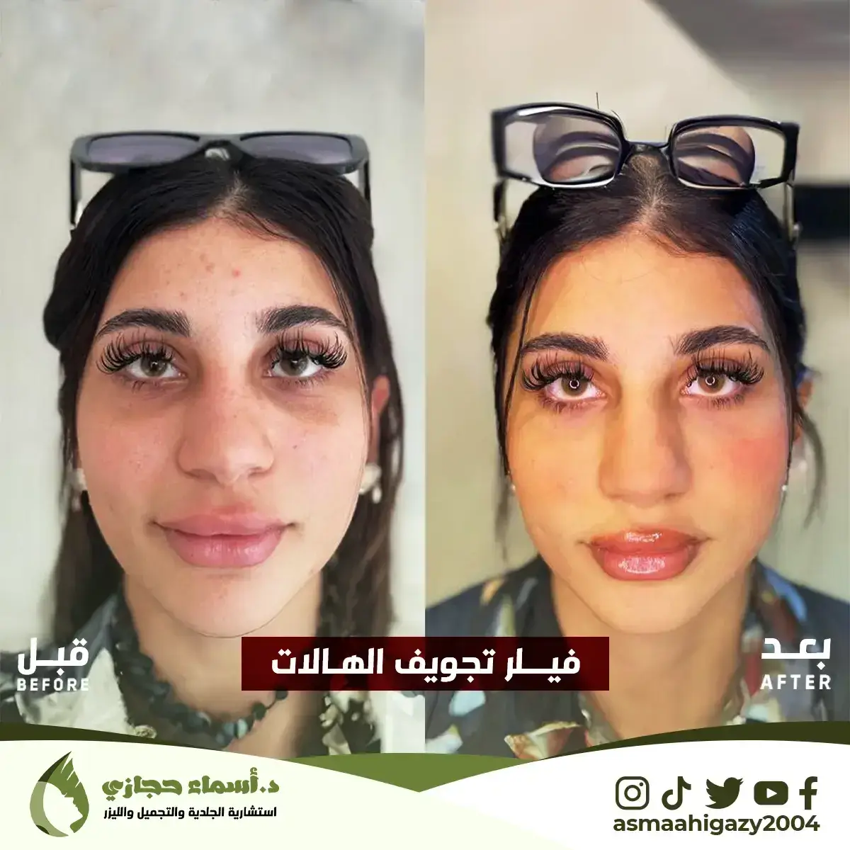 Jo-25-Apr-23-B&Amp;A-Filler-8 Copy