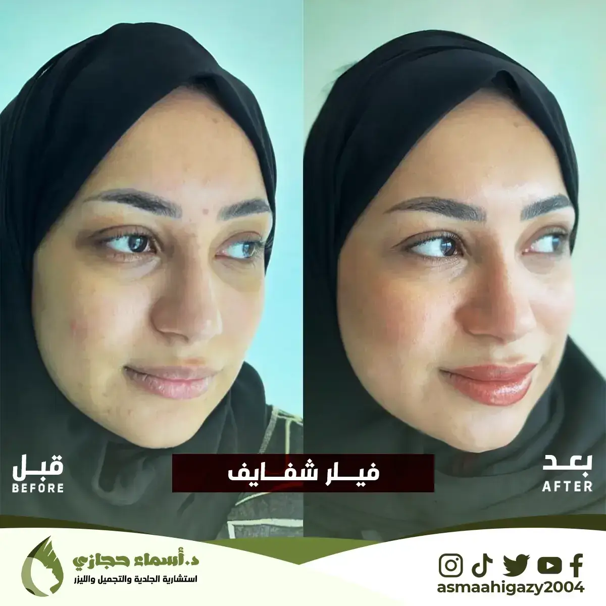 Jo-25-Apr-23-B&Amp;A-Filler-9 Copy