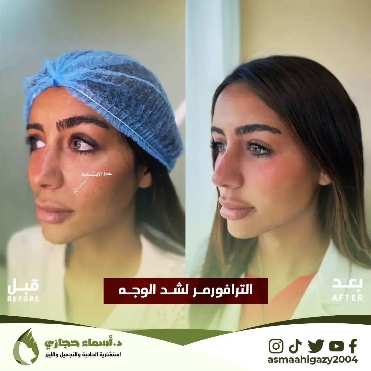 Jo-25-Apr-23-B&Amp;A-الشدالمائي-10 Copy