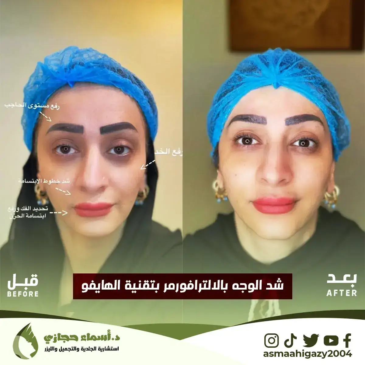 Jo-25-Apr-23-B&Amp;A-الشدالمائي-3 Copy