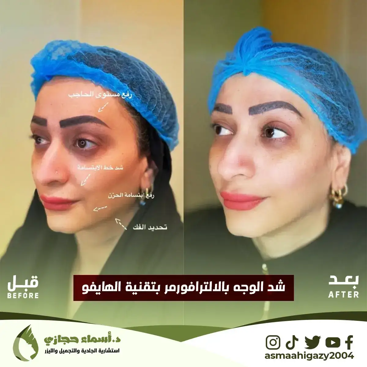 Jo-25-Apr-23-B&Amp;A-الشدالمائي-4 Copy