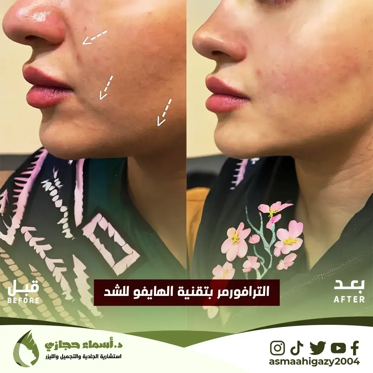 Jo-25-Apr-23-B&Amp;A-الشدالمائي-5 Copy