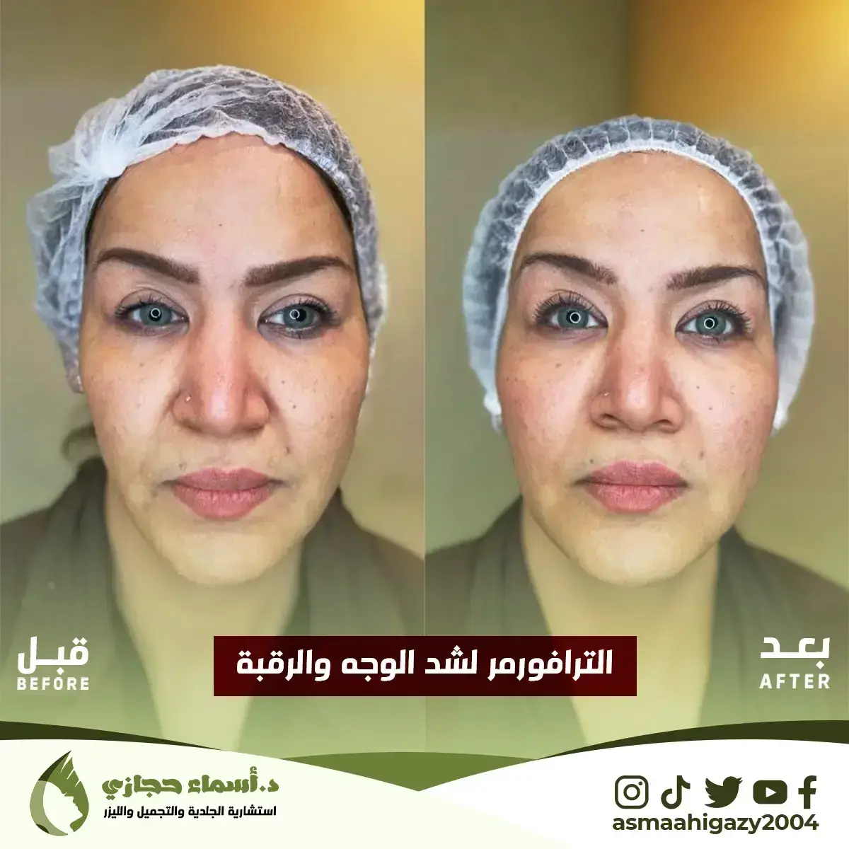 Jo-25-Apr-23-B&Amp;A-الشدالمائي-6 Copy