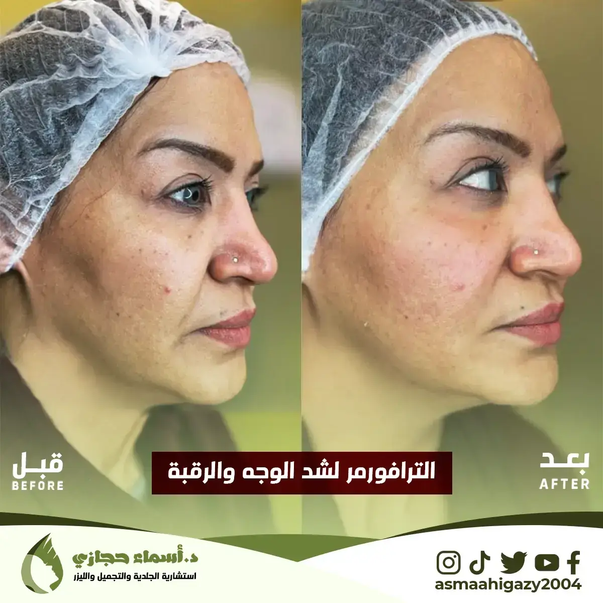 Jo-25-Apr-23-B&Amp;A-الشدالمائي-7 Copy