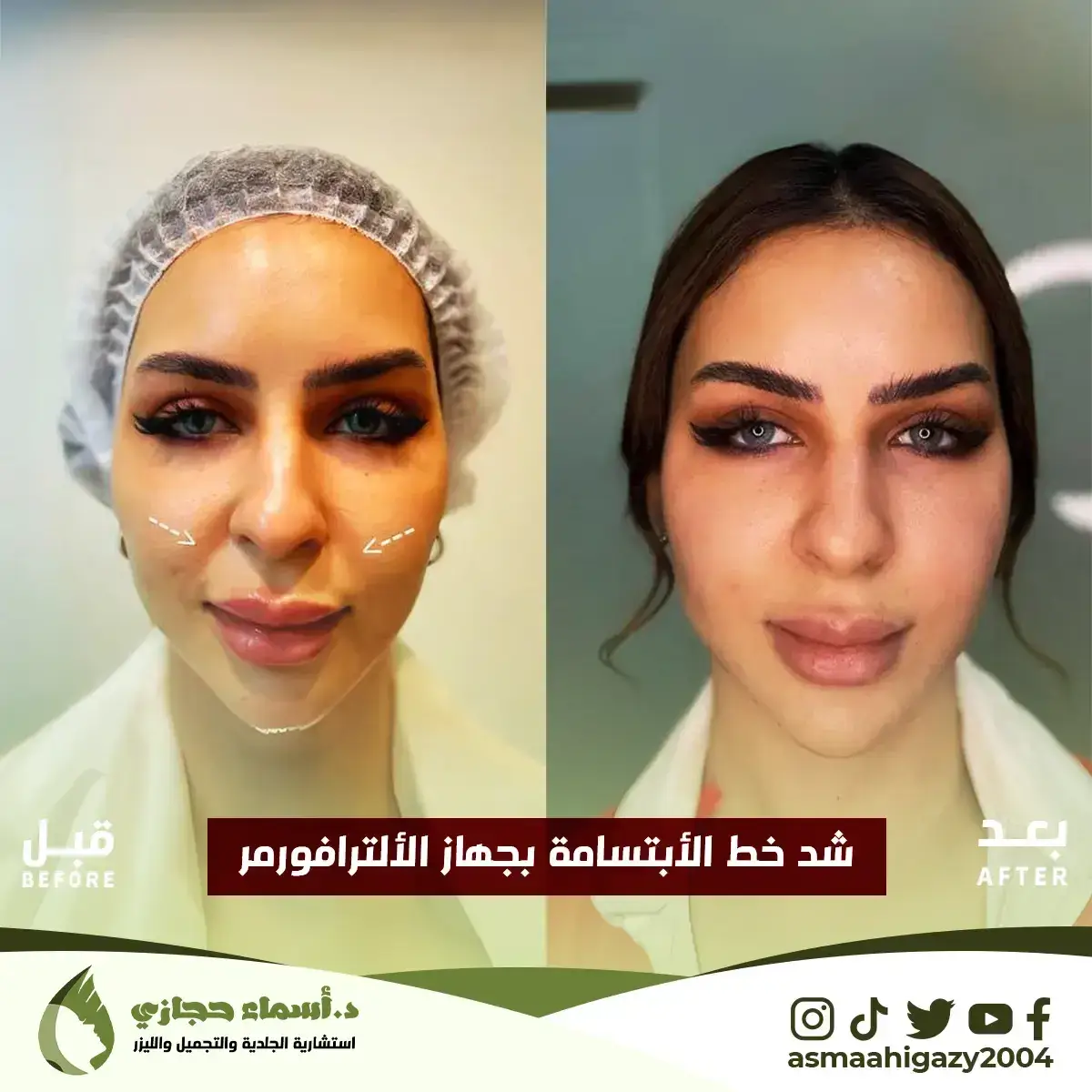 Jo-25-Apr-23-B&Amp;A-الشدالمائي-8 Copy