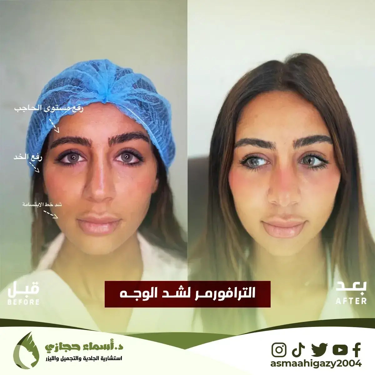 Jo-25-Apr-23-B&Amp;A-الشدالمائي-9 Copy