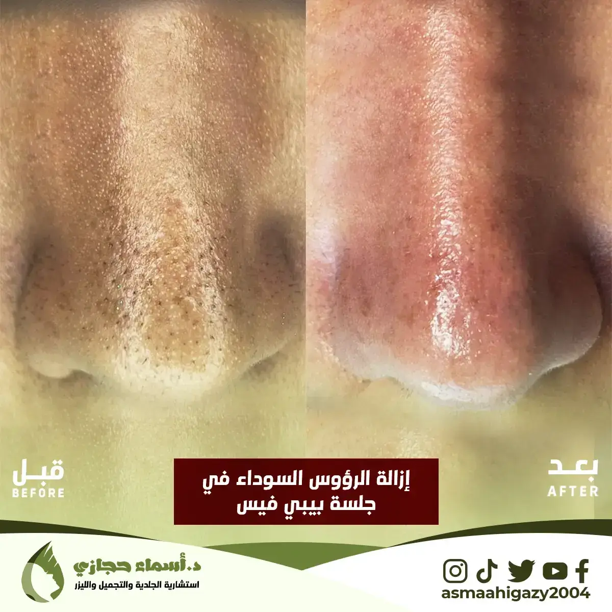 Jo-25-Apr-23-B&Amp;A-حبالشباب-1Copy