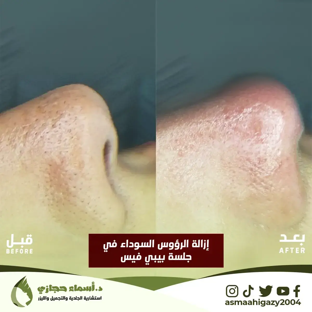 Jo-25-Apr-23-B&Amp;A-حبالشباب-2Copy