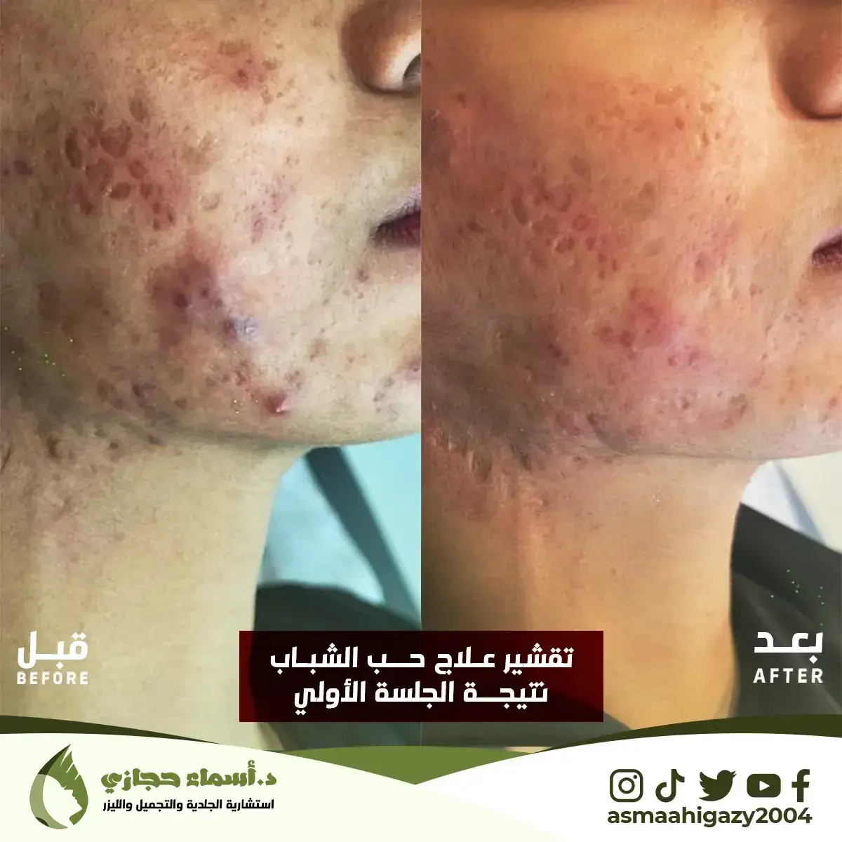 Jo-25-Apr-23-B&Amp;A-حبالشباب-3Copy