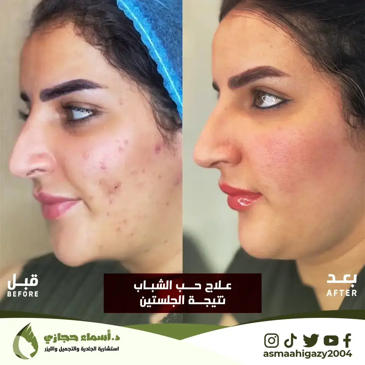 Jo-25-Apr-23-B&Amp;A-حبالشباب-4Copy