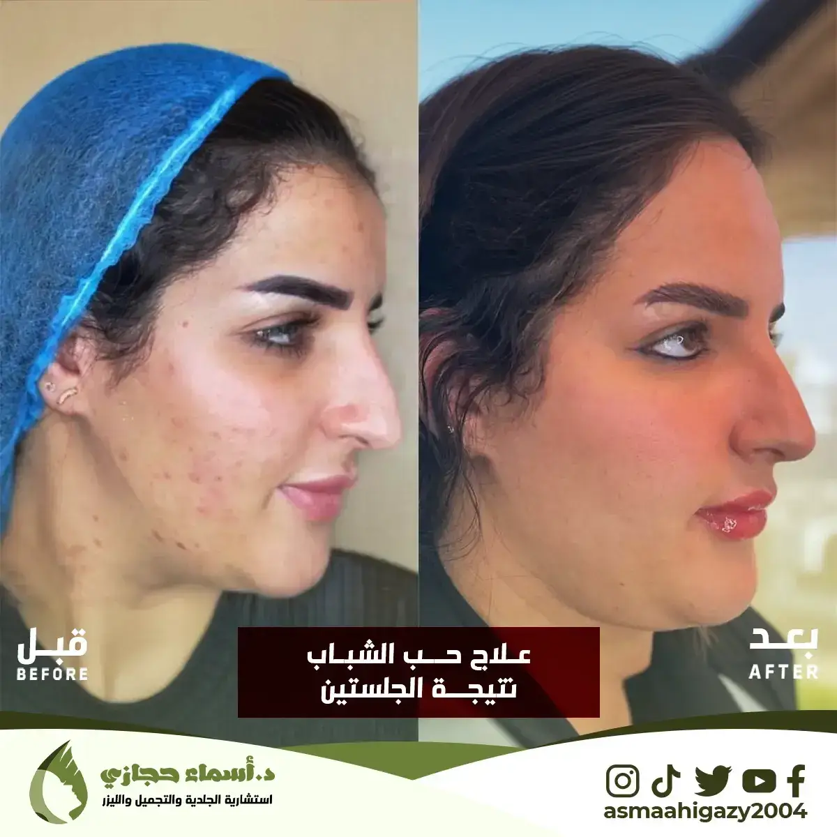 Jo-25-Apr-23-B&Amp;A-حبالشباب-5Copy