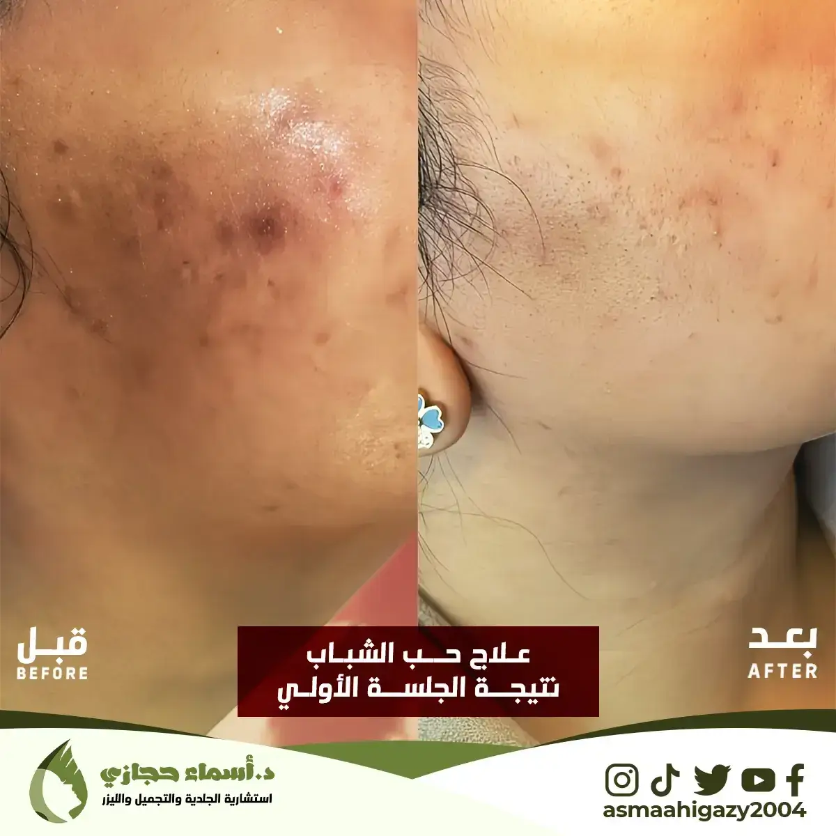 Jo-25-Apr-23-B&Amp;A-حبالشباب-6Copy