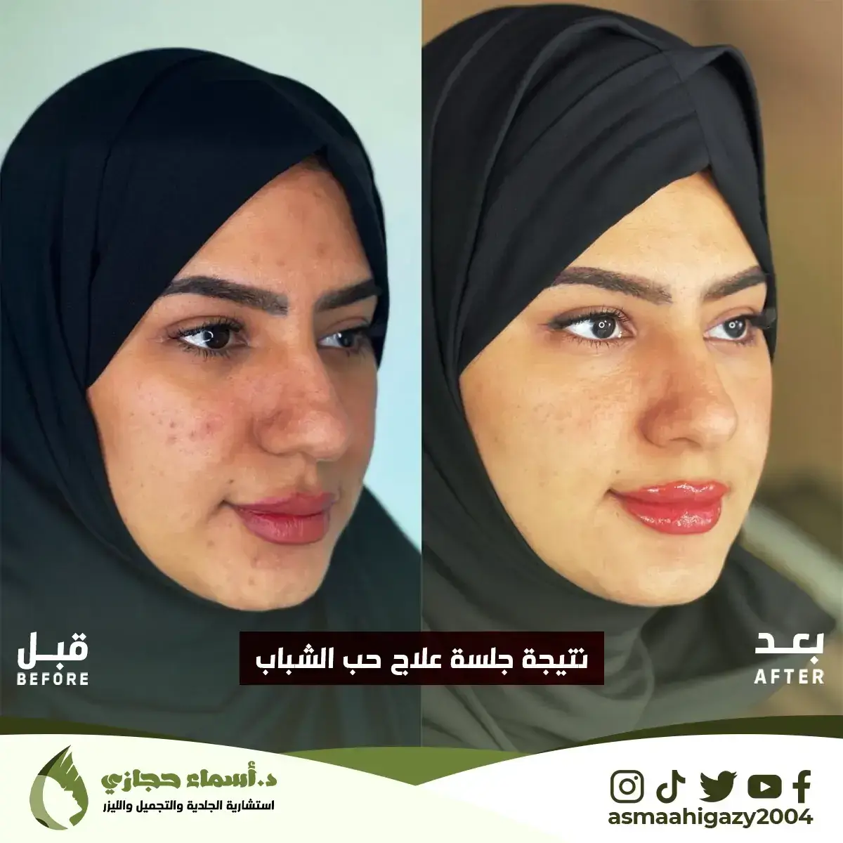 Jo-25-Apr-23-B&Amp;A-حبالشباب-7Copy