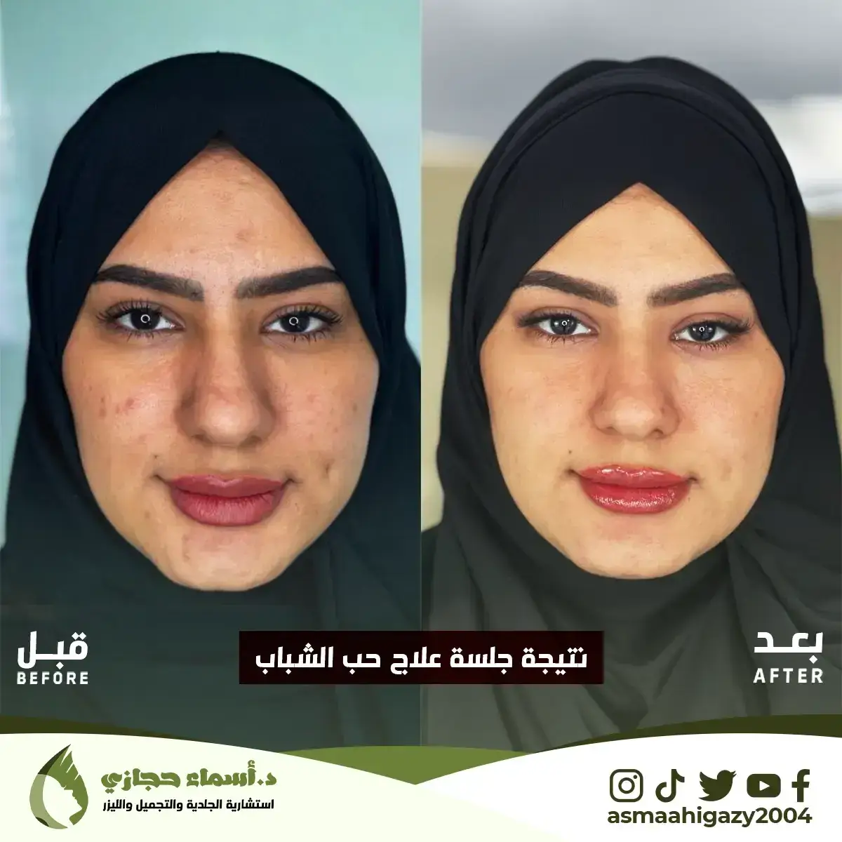 Jo-25-Apr-23-B&Amp;A-حبالشباب-8Copy