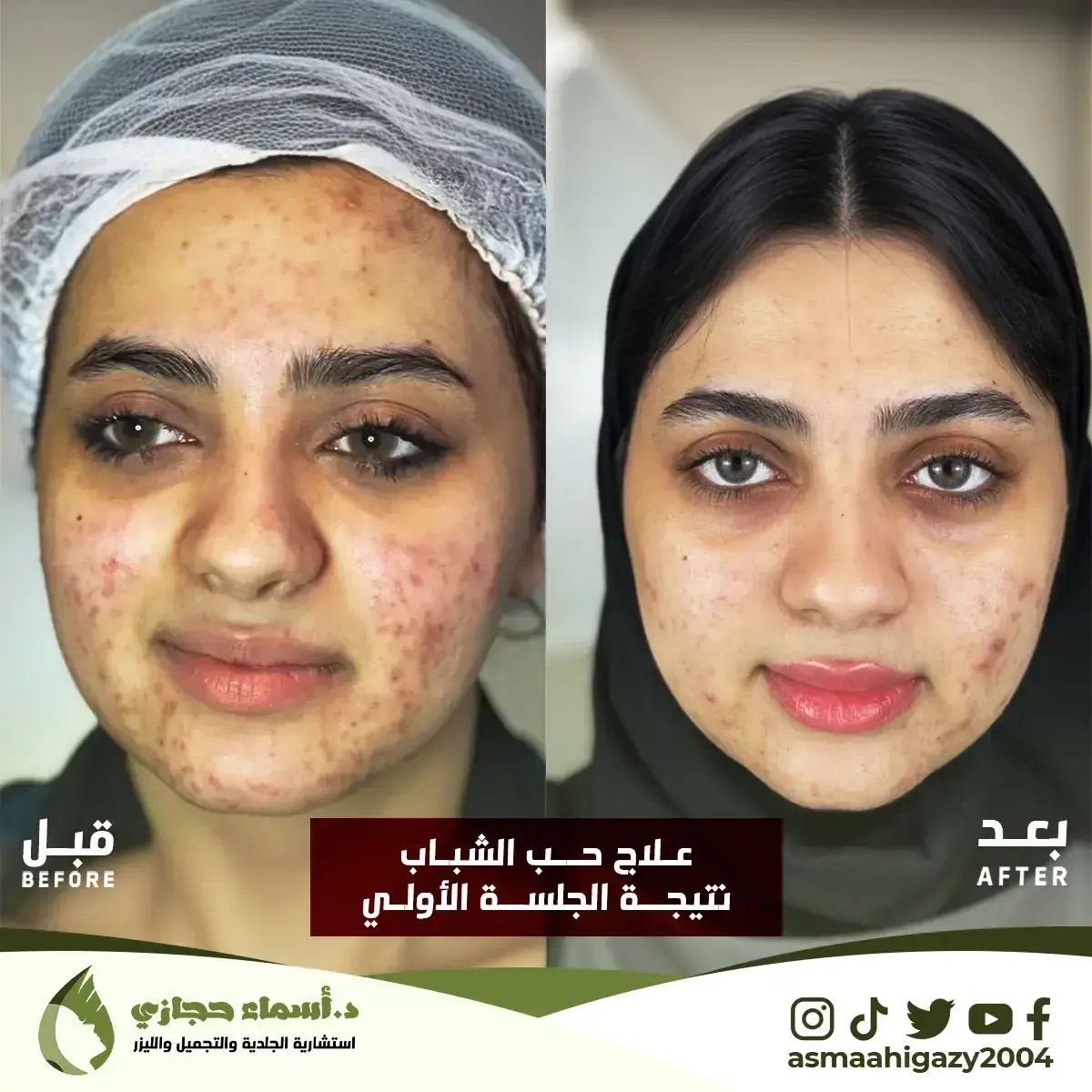 Jo-25-Apr-23-B&Amp;A-حبالشباب-9Copy