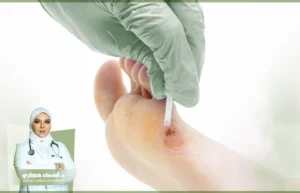 تجربتي مع عين السمكة