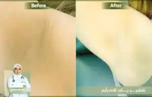 التصبغات الجلدية
