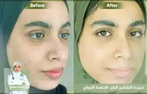 التصبغات الجلدية