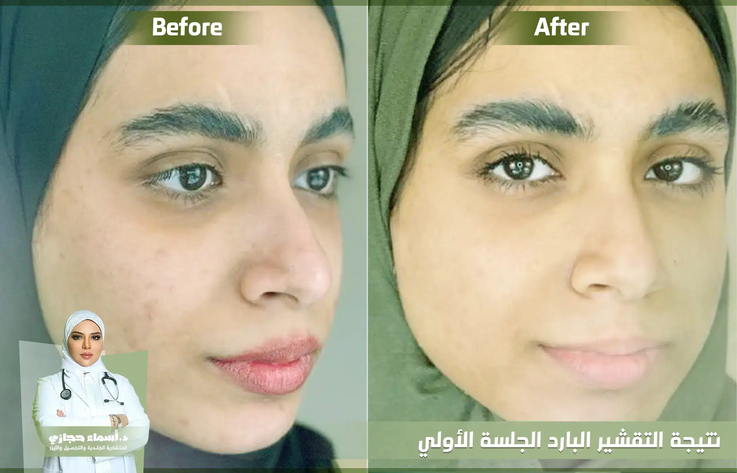 Jo 25 May 25 Artical 3 Copy | الموقع الالكتروني للدكتورة اسماء حجازي التصبغات الجلدية