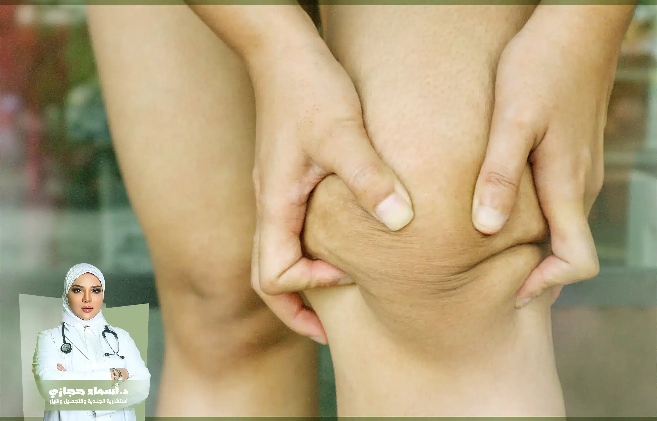 Jo 25 May 26 Artical 2 Copy | الموقع الالكتروني للدكتورة اسماء حجازي التصبغات الجلدية