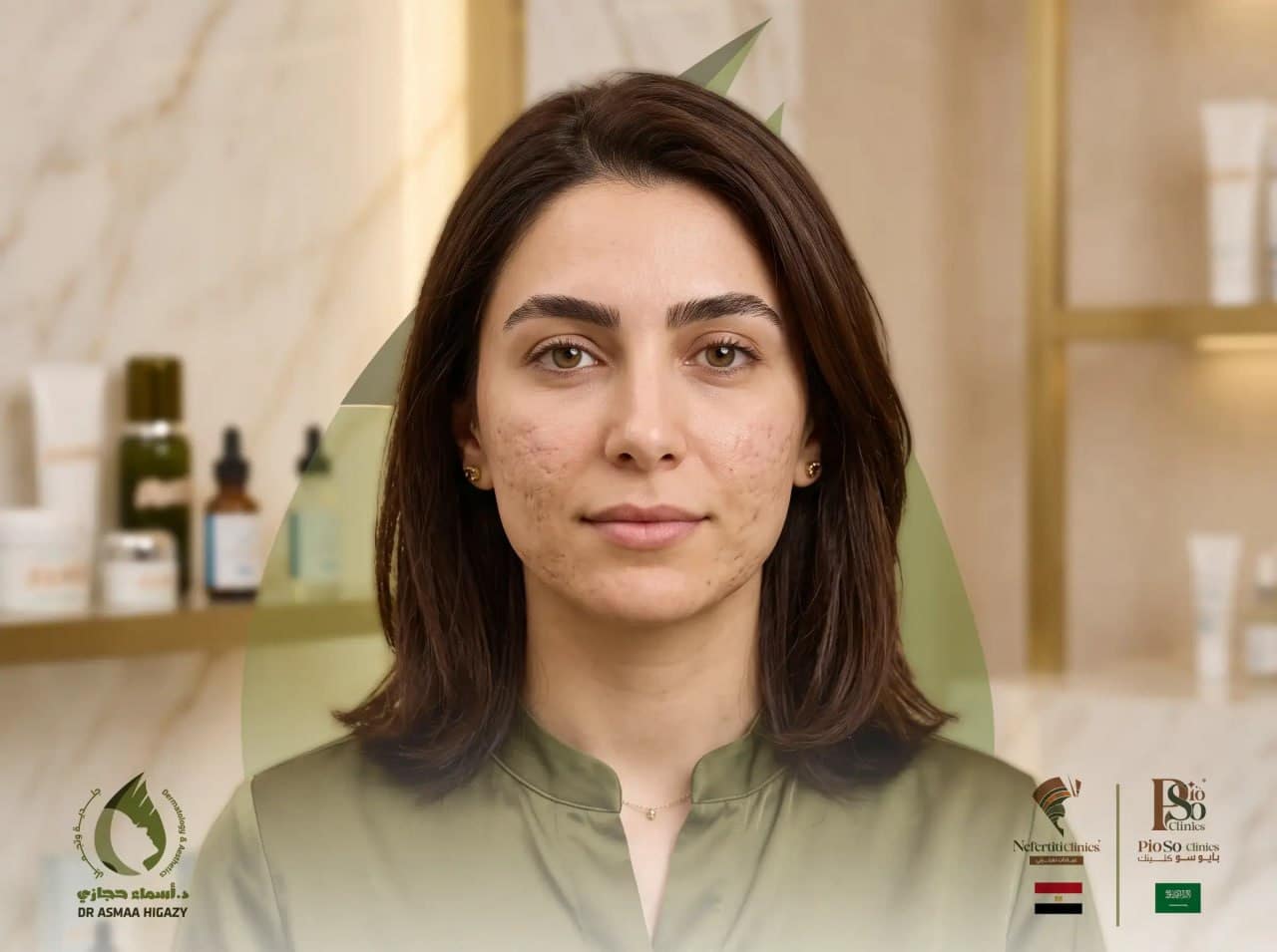 قطع الندبات 