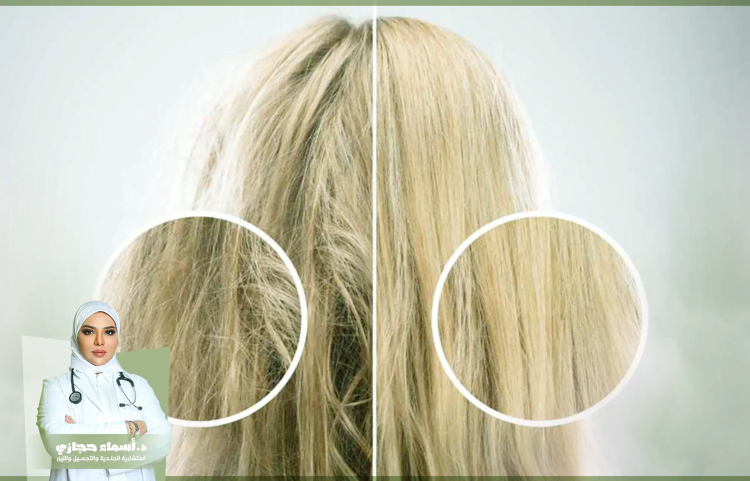 العنايه بالشعر 2025