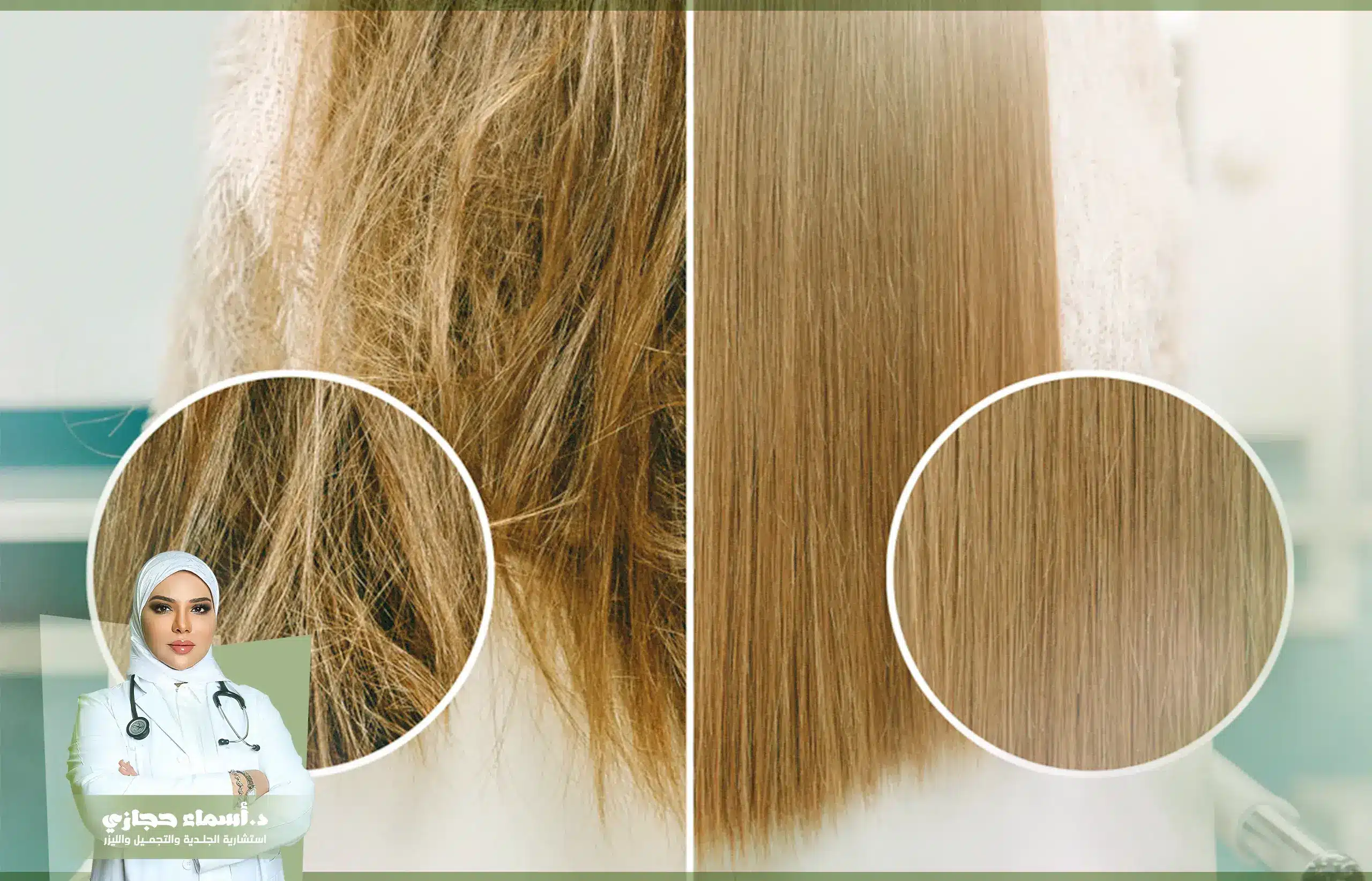 العنايه بالشعر 2025