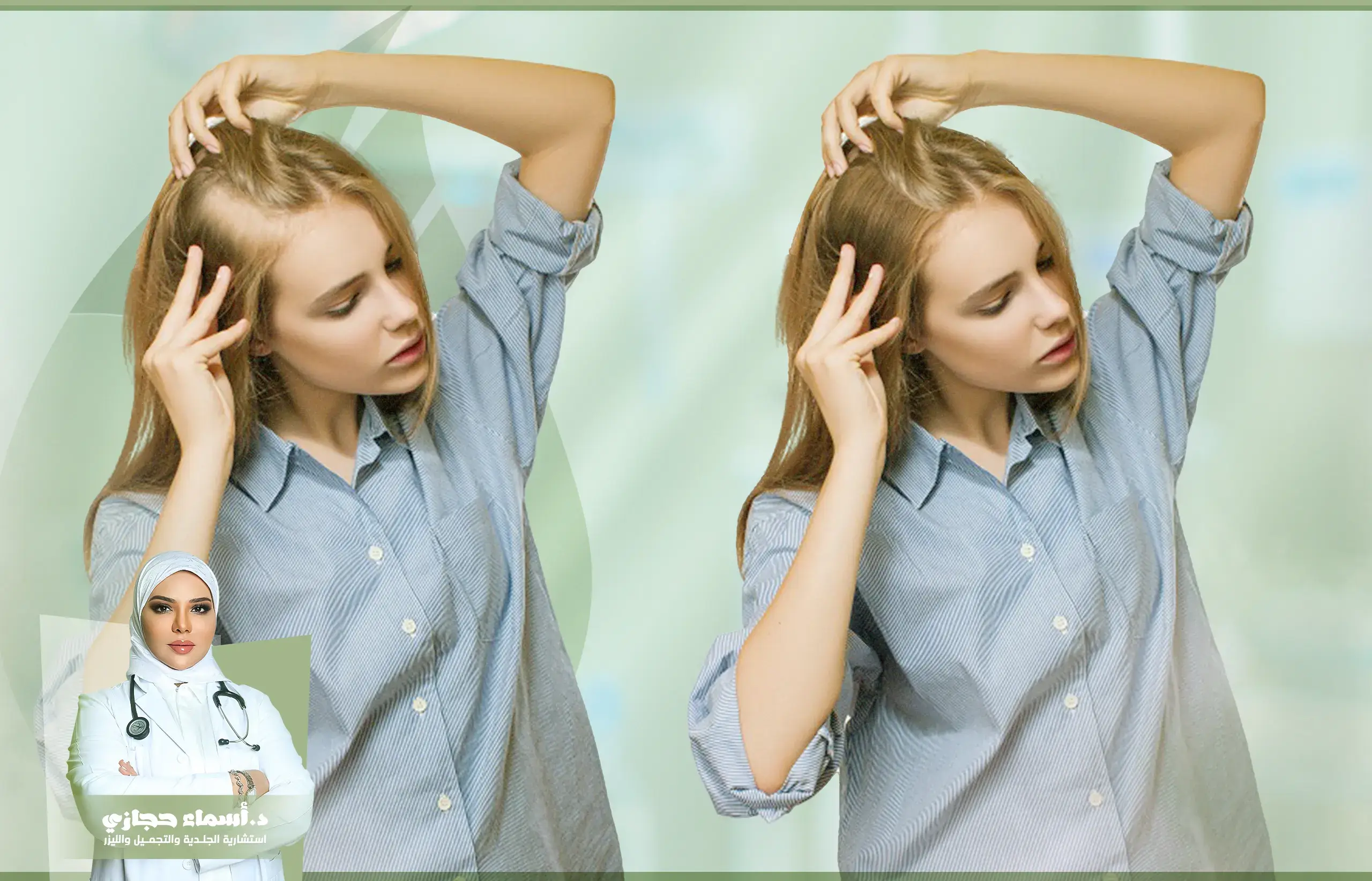 العنايه بالشعر 2025