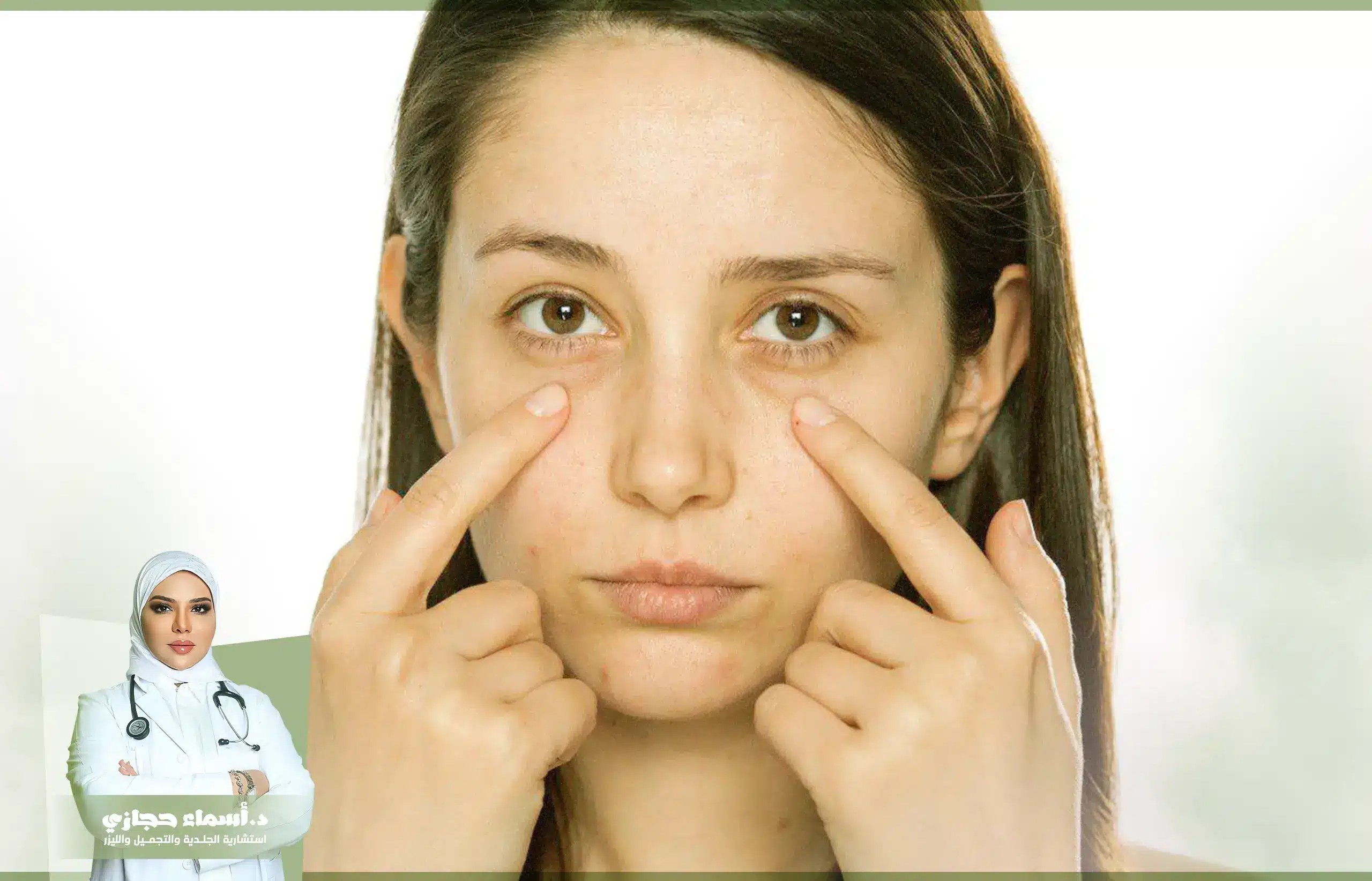 إبرة العنبر تحت العين