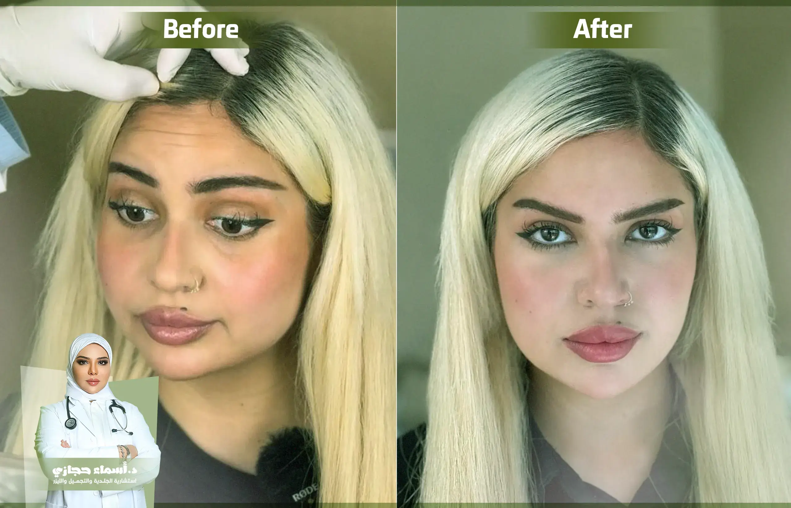 Jo 25 Aug 18 Artical 1 Copy | الموقع الالكتروني للدكتورة اسماء حجازي أفضل دكتور حقن بوتكس في جدة