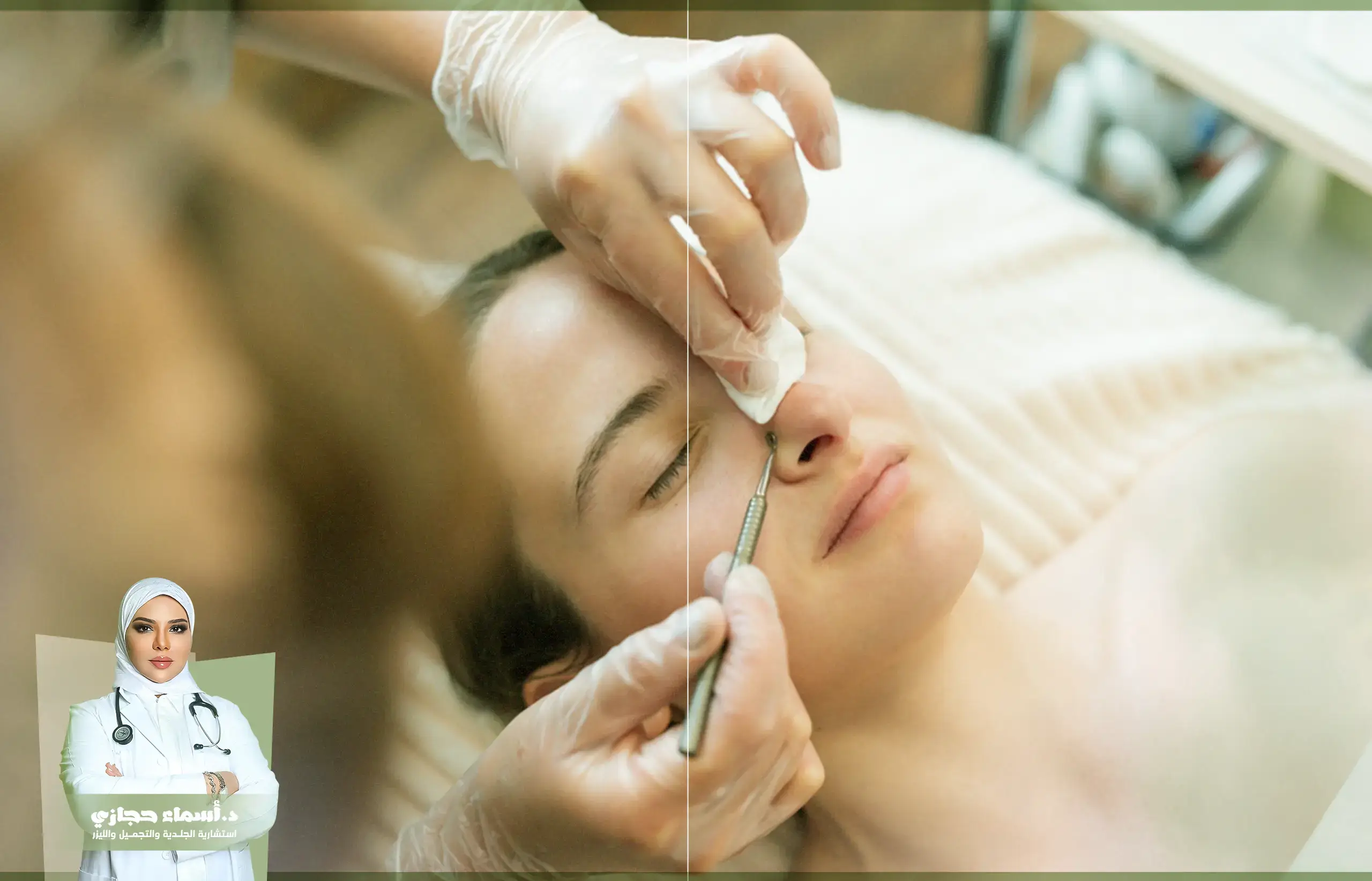 جلسة تنظيف البشرة مع دكتورة أسماء حجازي في سوهاج