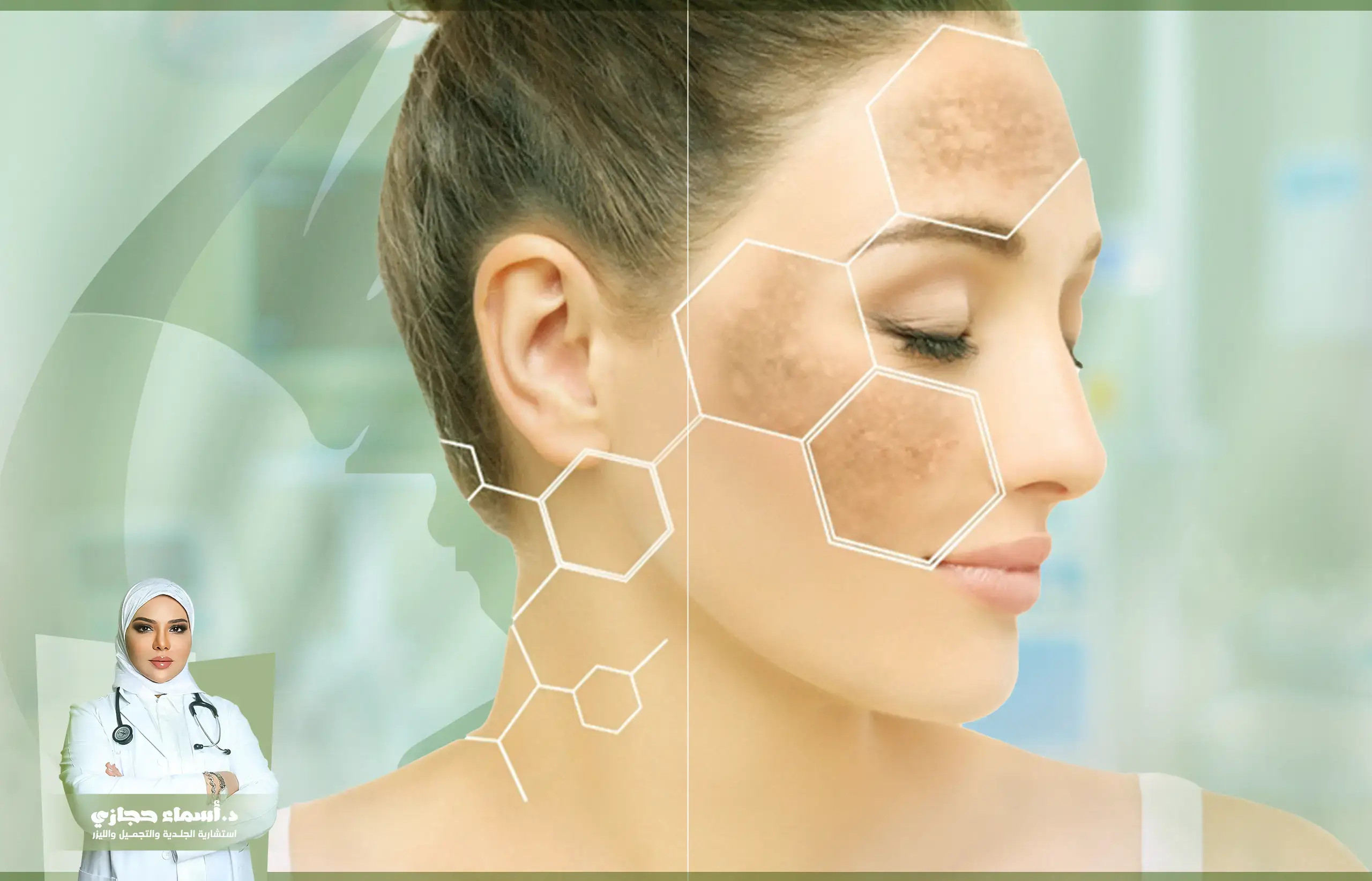 غلاج الكلف للحامل | الموقع الالكتروني للدكتورة اسماء حجازي علاج الكلف أثناء الحمل