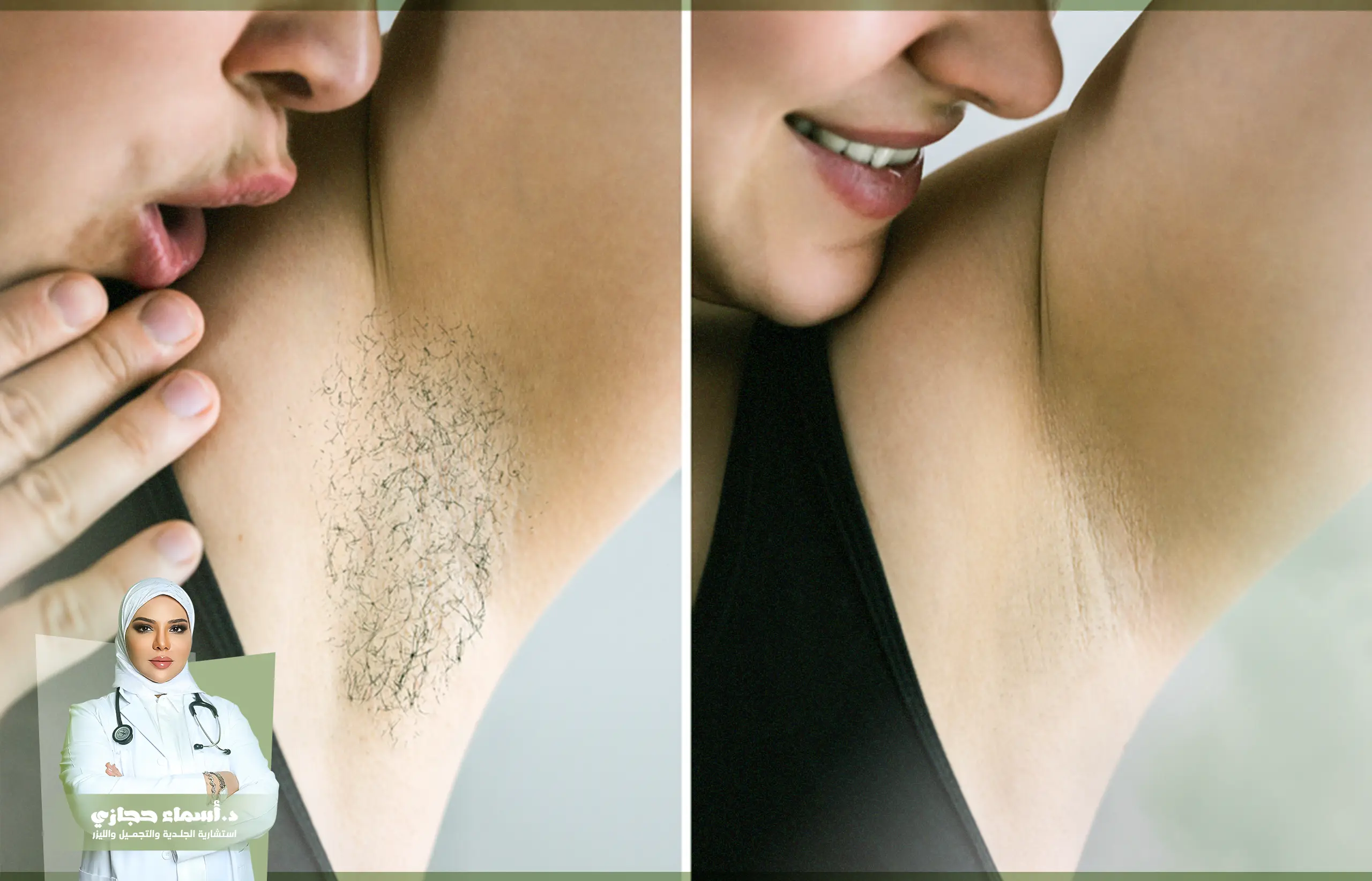 الشعر بعد جلسات الليزر | الموقع الالكتروني للدكتورة اسماء حجازي اذا طلع الشعر بعد الليزر كيف اشيله