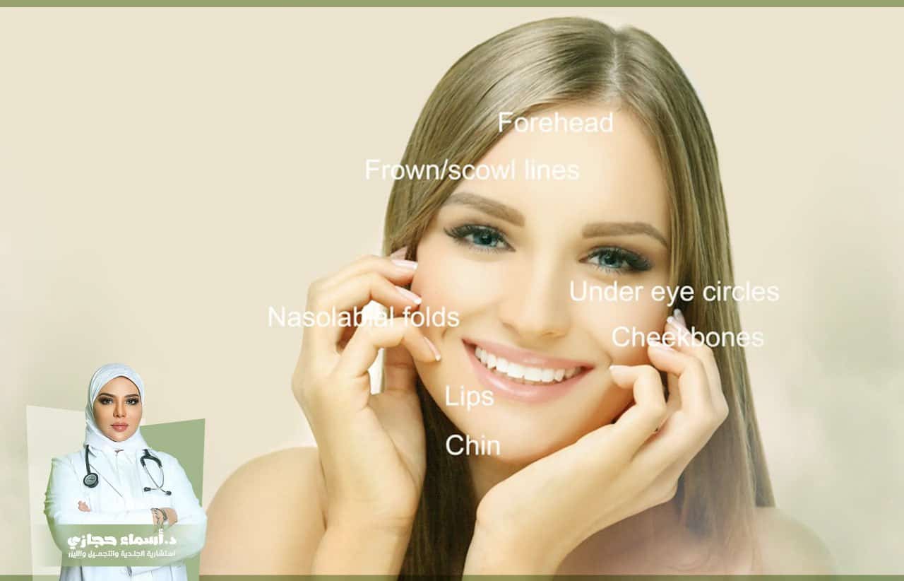 مواضع حقن الفيلر للوجه