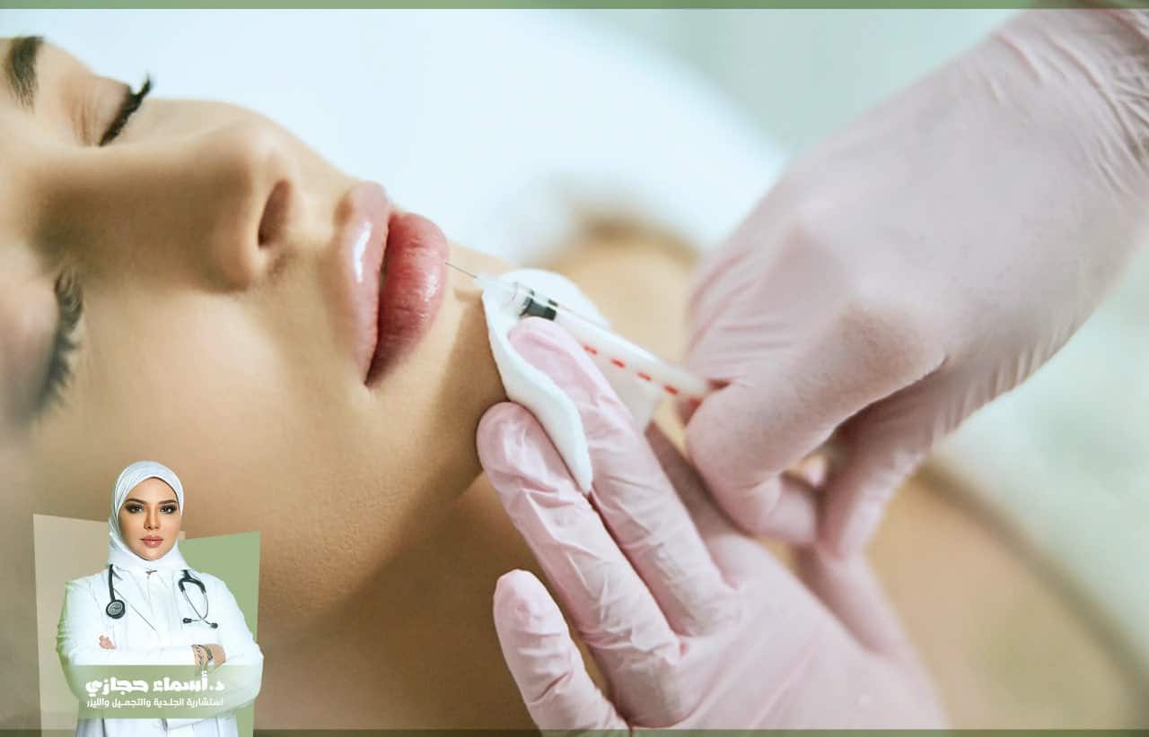 مواضع حقن الفيلر للوجه