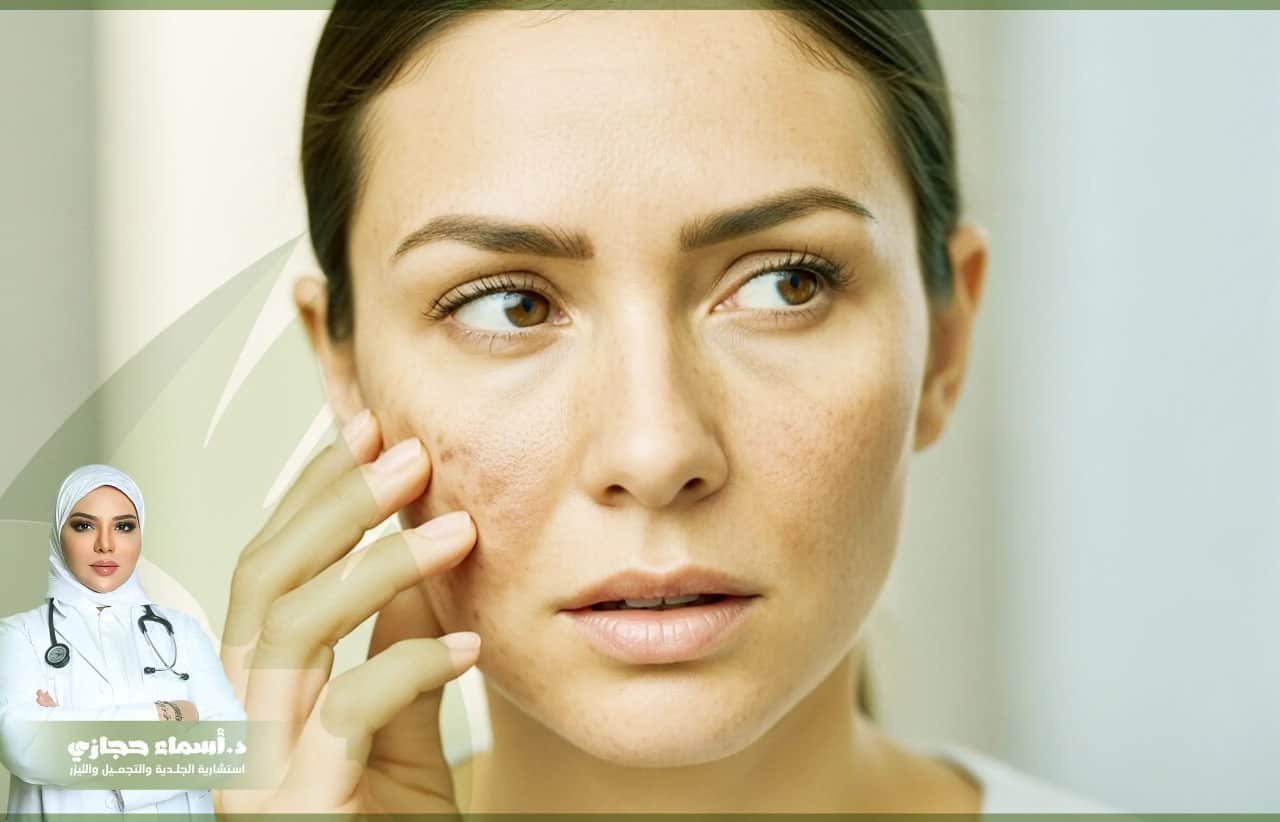 أفضل دكتورة جلدية في جدة