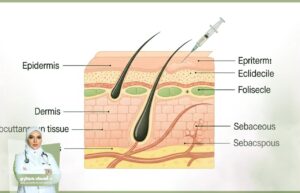 مخاطر التجميل غير الجراحي