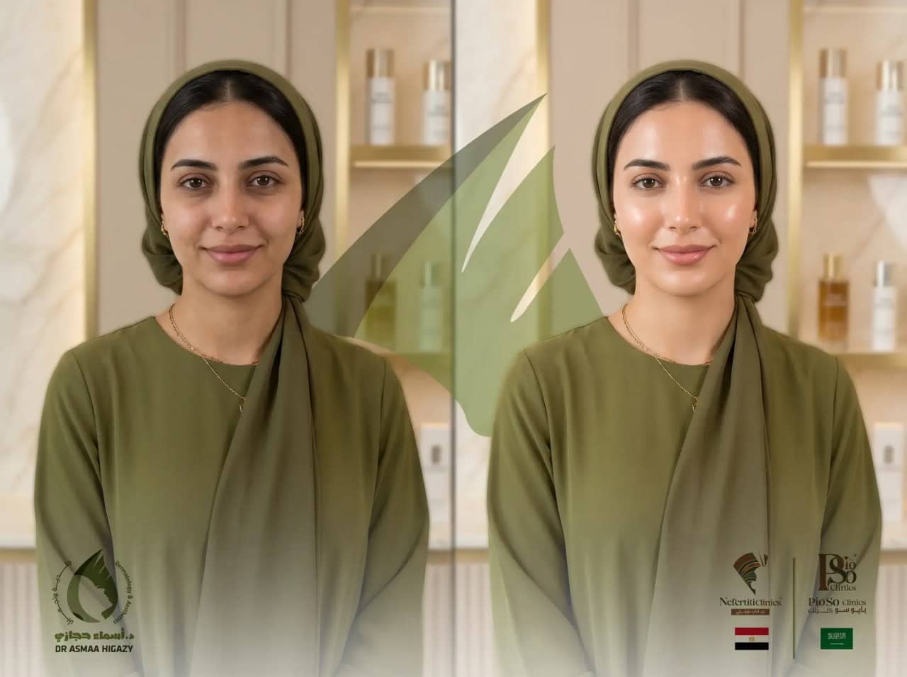نضارة البشرة